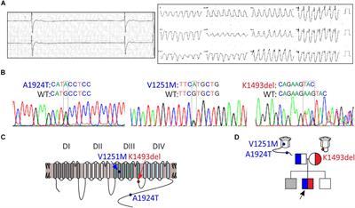 Mutations in NaV1.5 Reveal Calcium-Calmodulin Regulation of Sodium Channel